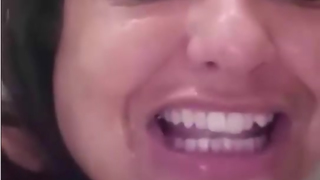 Anal top closefans